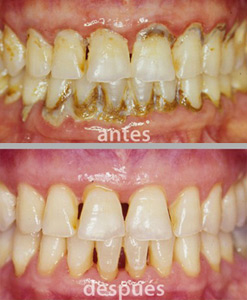 periodoncia